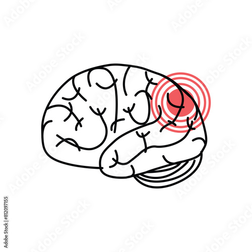 concussion brain or head ache thin line icon. linear trend modern simple logotype graphic lineart design isolated on white background. concept of