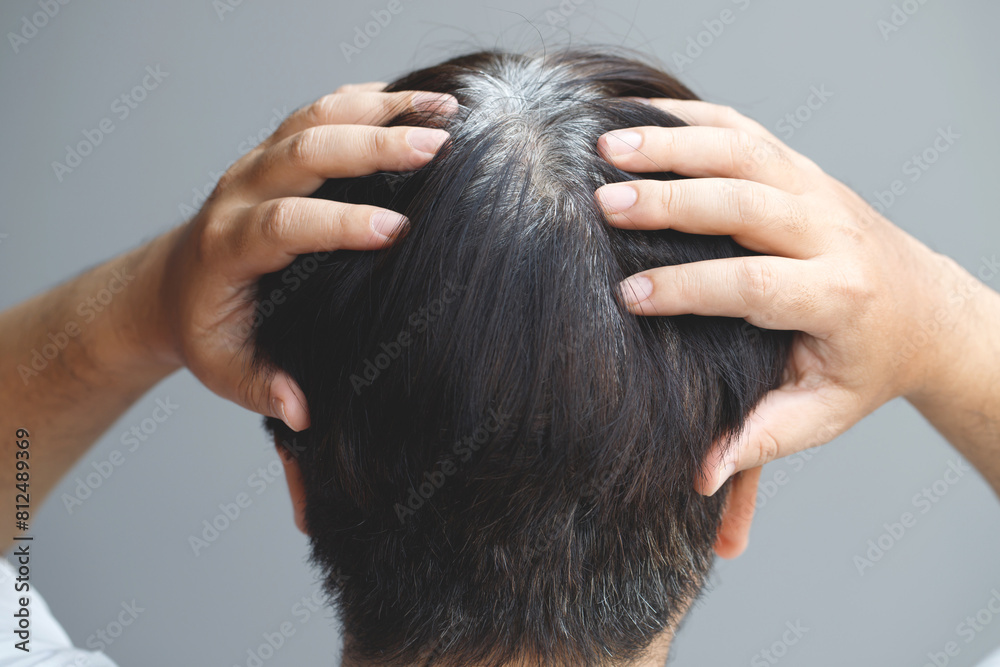 Naklejka premium Back view of young people premature gray hair, showing black hoary hair roots on head change to senior old man outdoor.