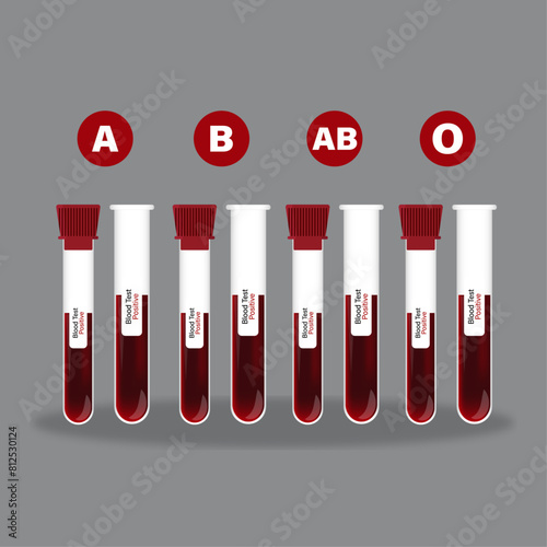Vector illustration of different blood types in test tube flat vector design, Medical care concept illustration.
