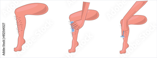 Waxing, human body wax, leg waxing hand drawing vector illustration