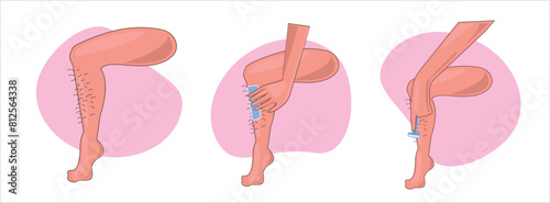 Waxing, human body wax, leg waxing hand drawing vector illustration
