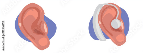 Ear, ear cleaning and hearing aid vector illustration