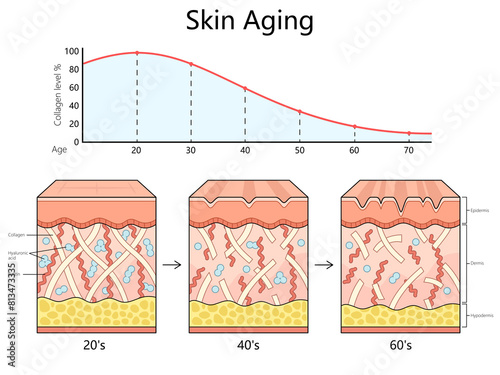 Canvas Print skin aging process from the 20s to the 60s, showing the decrease in collagen, elastin, and hyaluronic acid diagram hand drawn schematic raster illustration