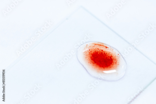Blood group and rh factor testing by Doctor and Make a permanent slide In the Laboratory. 