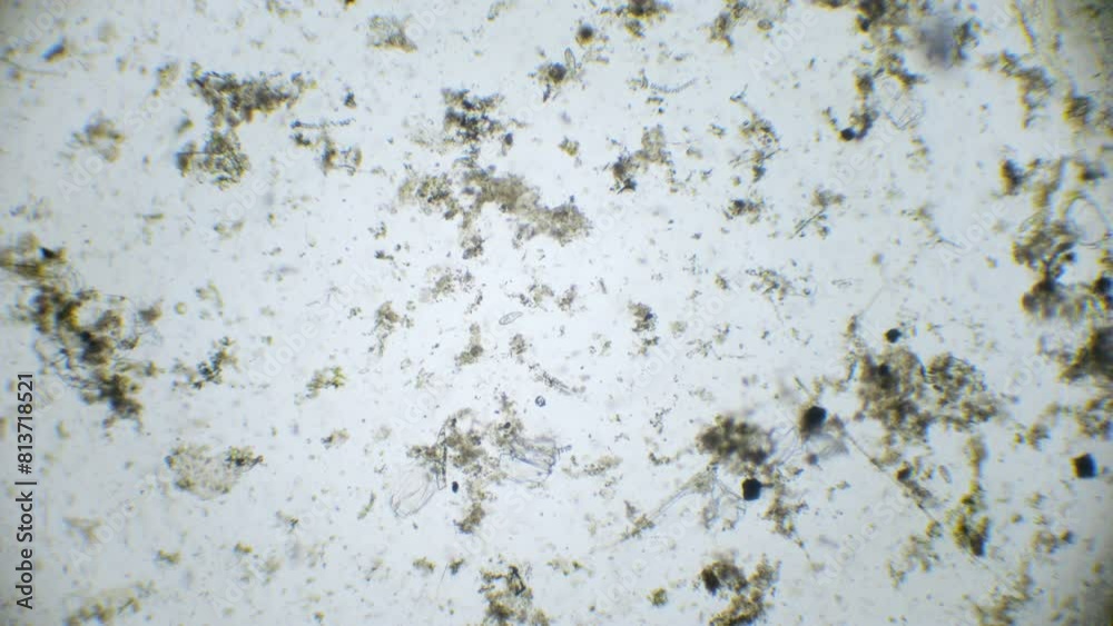 Paramesia A microscopic lens captures the lively dance of paramecia and spirulina ...