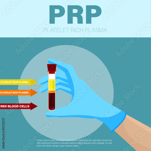 Vector illustration of prp poster with text place, hand holding a test tube filled with blood for platelet rich plasma.  Medical health care vector design.