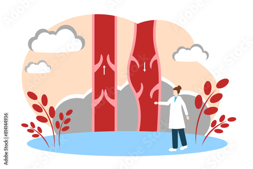 Varicose veins. Phlebology, Human Anatomy and Medicine