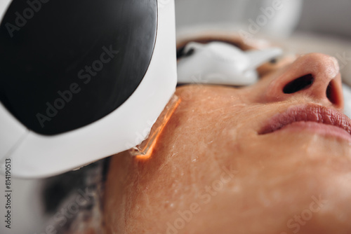 A woman receives IPL therapy in a beauty salon.