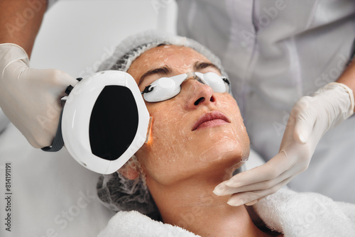 A woman receives IPL therapy in a beauty salon.