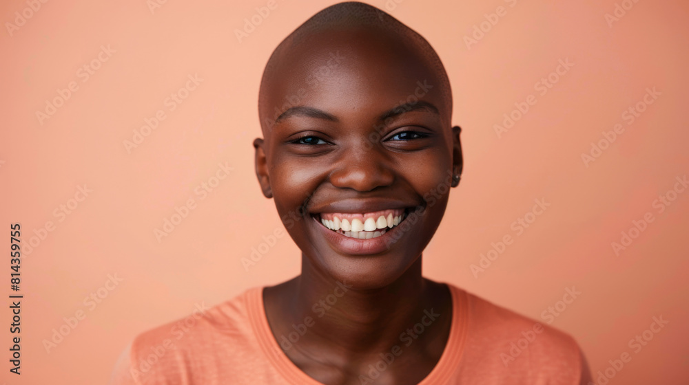 A woman with a shaved head is smiling, cancer patient with chemotherapy A woman with a shaved head is smiling, cancer patient with chemotherapy