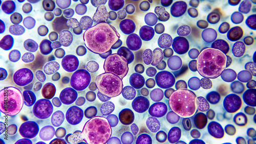 Close-up of bone marrow aspirate under a microscope photo