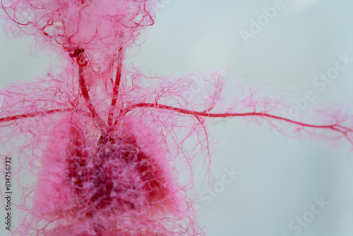 cardiovascular system background It is a medical procedure used to display images of blood vessels