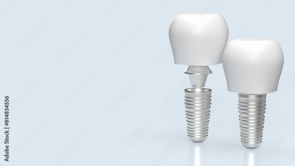 The dental implants for health and medical concept 3d rendering. The dental implants for health and medical concept 3d rendering.