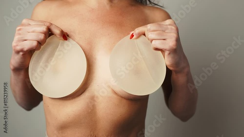 Body Transformation: Woman Holds Removed Breast Implants photo