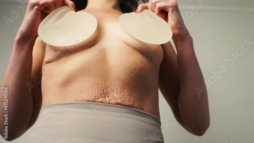 Recovery Journey: Woman Shows Removed Breast Implants photo