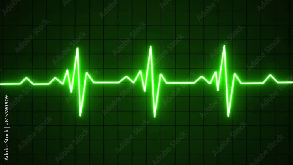 Glowing neon green color heartbeat rate and pulse line with grid, EKG, ECG, seamless and loop motion animate footage. Cardiogram cardiograph oscilloscope screen. Glowing neon green color heartbeat rate and pulse line with grid, EKG, ECG, seamless and loop motion animate footage. Cardiogram cardiograph oscilloscope screen.