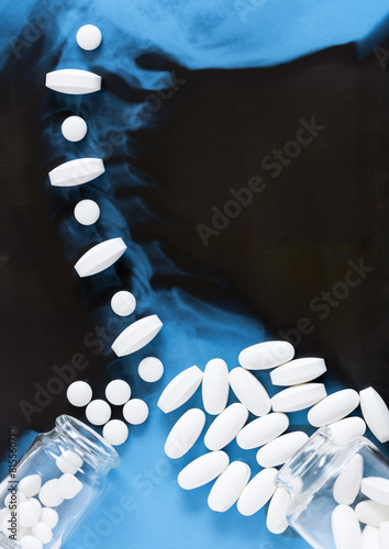 Concept of treatment and prevention of diseases of cervical spine. Top view of white pain pills lying on neck x-ray. Empty space for text on black background. Flat lay, close-up, copy space, mock up