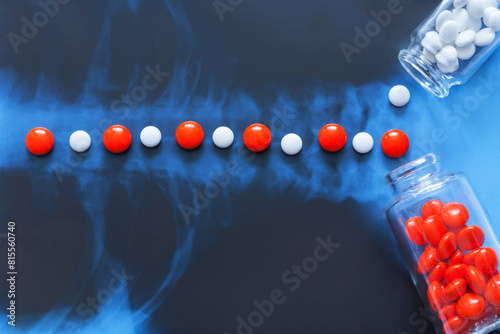 Close-up view of white and red pain pills lying on neck x-ray radiogram. Concept of treatment of diseases of cervical spine. Empty space for text on black background. Flat lay, close-up, copy space