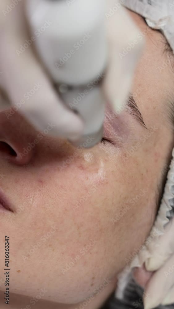 Non-injection mesotherapy Non-injection mesotherapy