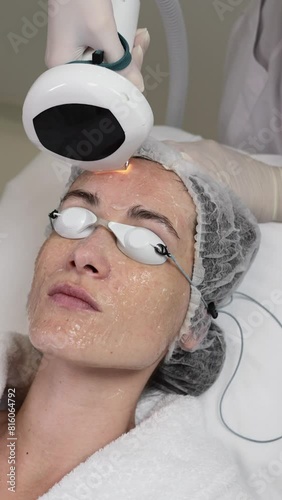A woman receives IPL therapy in a beauty salon.