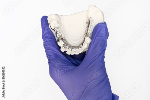 Isolated Metal Frame Lower Partial Denture with Die Stone, Plaster Cast Molds Of Lower Jaws in Gloved Human Hand on White Background, Cobalt Chrome Dental Plate, 3D Printed Bridge. Horizontal Plane. photo