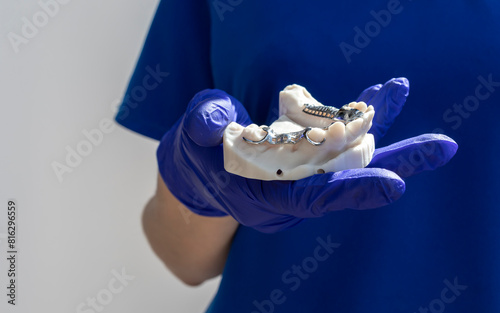 Cropped Doctor with Metal Frame Lower Partial Denture with Die Stone, Plaster Cast Molds Of Lower Jaws in Gloved Hand on White Background, Cobalt Chrome Dental Plate, 3D Printed Bridge. Horizontal photo