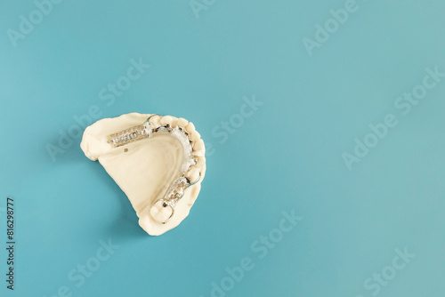 Mockup Metal Frame Lower Partial Denture, Plate On Die Stone, Plaster Cast Mold Of Lower Jaws, Cobalt Chrome Dental Plate, Flat Lay Mockup 3D Printed Bridge On Blue Background. Copy Space. Horizontal photo