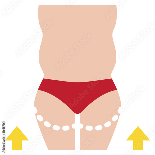 body liposuction fat surgery cosmetic beauty flat style