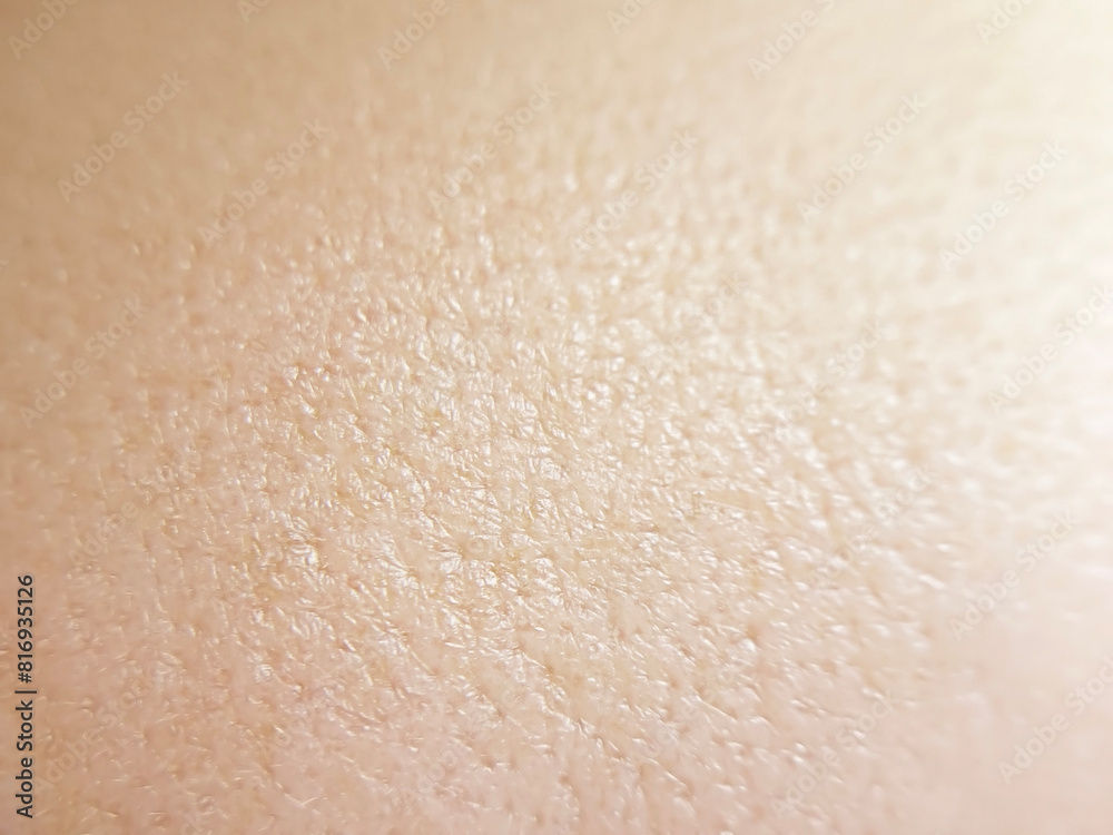 Fototapeta premium texture of human skin with enlarged pores close-up
