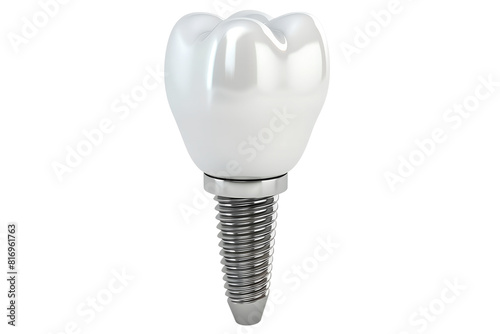 Dental implant screw, artificial white tooth, isolated on transparent background. Denture realistic closeup implant. Prosthesis, chewing denture