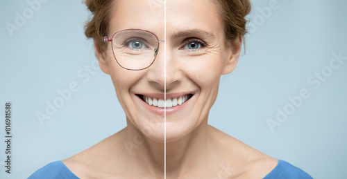 Laser vision correction. Woman face with and without glasses on blue background showing vision correction concept using eyeglasses