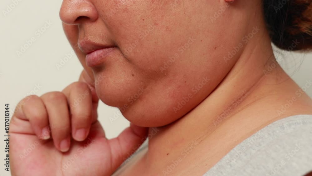Part of face shin - Fat Womans human anatomy & Body Parts. closeup human body isolated on white background studio