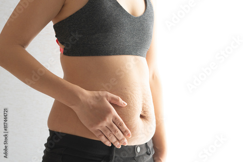 A fat Asian woman in black pants touches fat folds on her belly with stretch marks after childbirth.