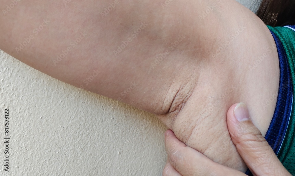 close up of a hand holding a Flabbiness and wrinkle under the arm, armpit hair and Flabby skin, loose and lines on the body of the woman, health care and beauty concept. close up of a hand holding a Flabbiness and wrinkle under the arm, armpit hair and Flabby skin, loose and lines on the body of the woman, health care and beauty concept.