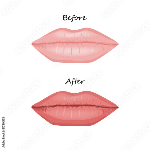 Woman lips before and after permanent makeup. Brighter color and freshness. Vector isolated illustration.