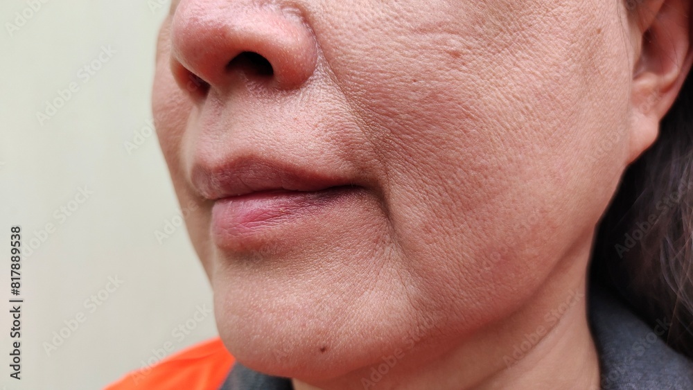 Obraz premium Close up the wrinkle and Flabby skin beside the mouth, dark spots and blemish on the face of the woman, health care and beauty concept.