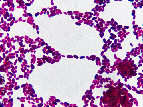 Yeast cells clump together when fixed on a glass slide and magnified under a microscope.
