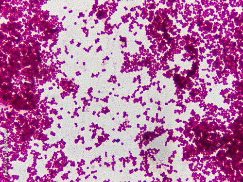 Large groups of red bacterial cells on a fixed preparation under a microscope magnification of 1000 times
