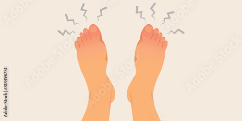 Swollen feet or numb feet feeling tingly. photo
