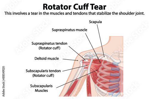 Detailed anatomy of shoulder muscle tear