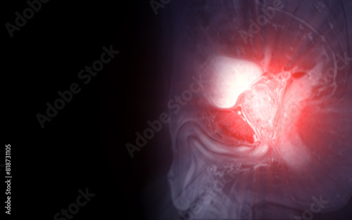 MRI of the prostate gland, revealing an enlarged size.