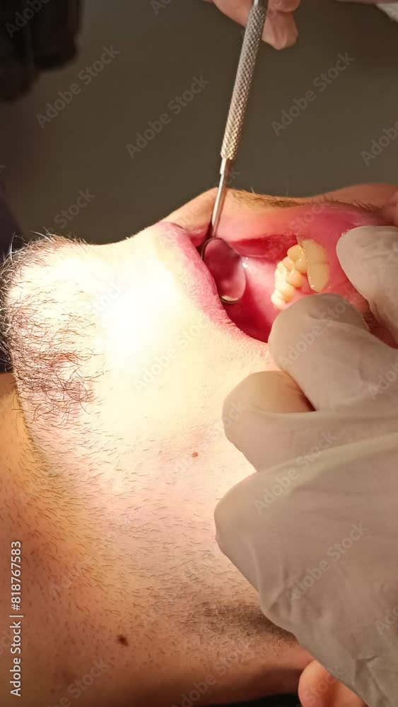 personne recevant des soins dentaires, en gros plan.