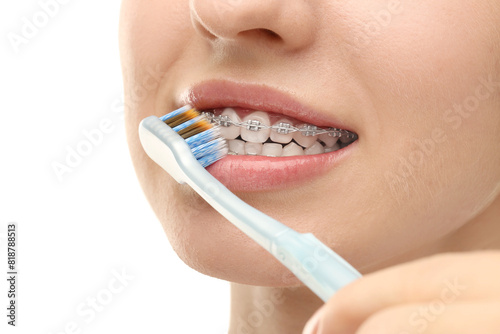 Woman with dental braces cleaning teeth on white background, closeup