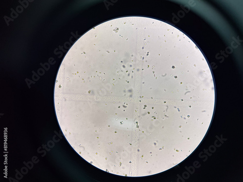 Uric acid crystay in urine. photo