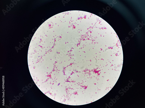 Bacteria cell gram neagtive bacilli. photo