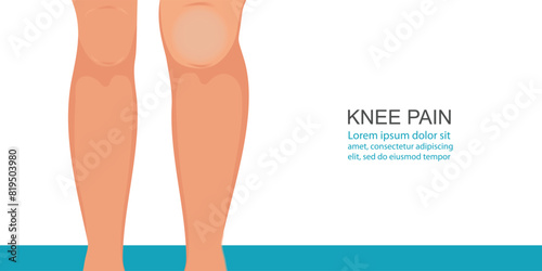 Body people with leg and Knee pain symptoms.