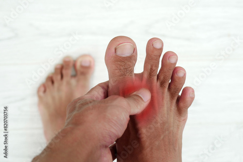 Hand holding toes with foot pain, joint pain, gout, pain and injury.