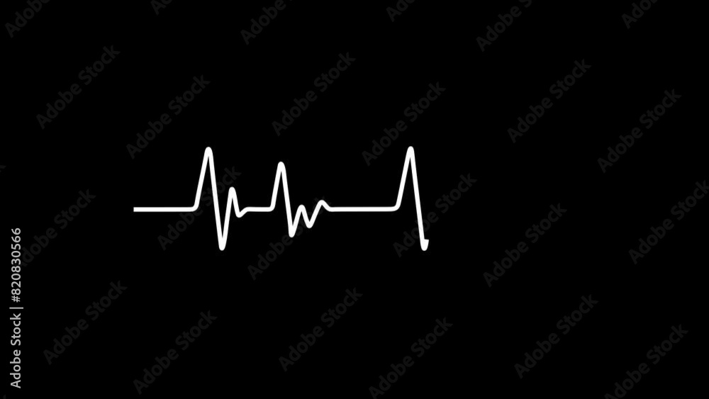 Digital Heartbeat Plus Animation.  heartbeat on the monitor. transparent video
