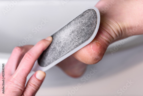 Woman's hands cleaning the heel with pumice in the bathroom. photo