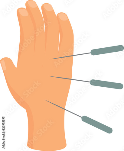 Detailed acupuncture hand model vector illustration for educational clinical practice and therapeutic procedure in alternative chinese medicine therapy